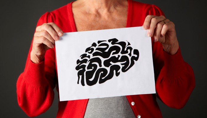 Alzheimerova choroba:
metla lidstva 21. století