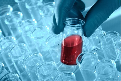 Hypochondři jsou důležití,
chrání nás před nákazami