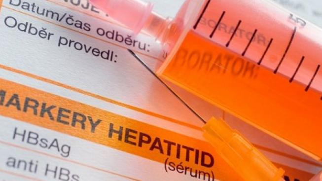 Pozor na žloutenku v cizině,
vyplatí se pořídit očkování