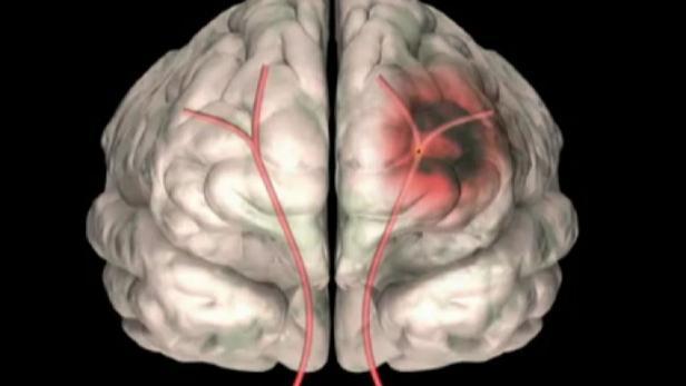Mrtvice: i při lehkých
příznacích volejte 155