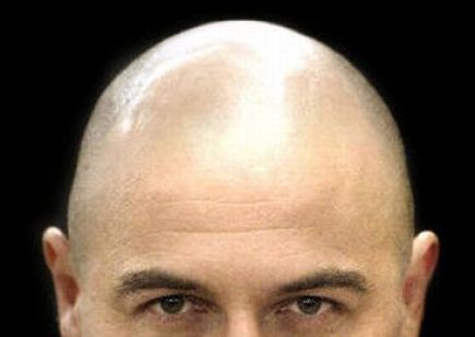 Holohlaví muži by si měli
dávat větší pozor na srdce