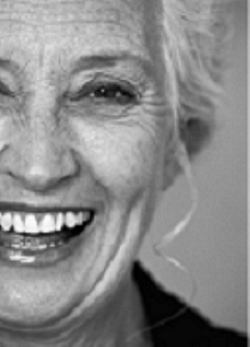 10. Vrásky smíchu u ženy