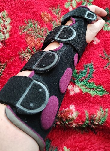 Ortéza coby záchrana