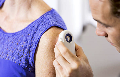 Melanomů přibývá. Pomohou preventivní prohlídky, ale i klid v duši