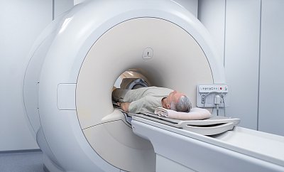 Screeningové programy zachycují ročně tisíce případů nádorových onemocnění