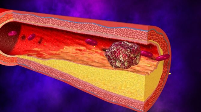 Obáváte se trombofilie?
Nechte si otestovat DNA!
