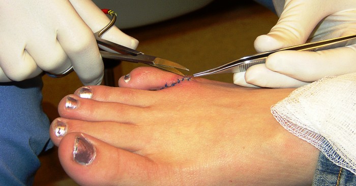 Pozor na nejčastější
úrazy v letním období