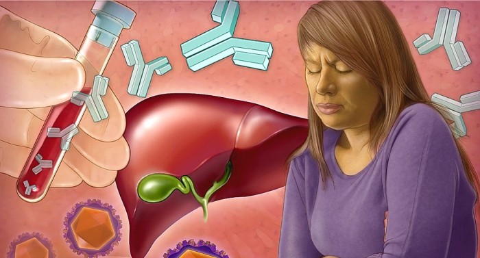 Začala řádit žloutenka, lékaři
doporučují zvýšenou hygienu